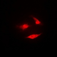Anti-PSMB2 Antibody