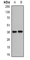 DDA3 Rabbit Polyclonal Antibody