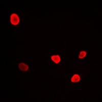 Anti-RFC4 Antibody
