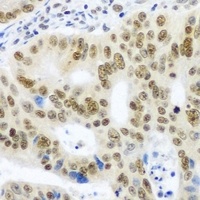 Anti-Sm E Antibody