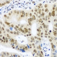 SNRPE antibody