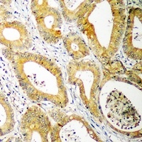 Anti-UBE2C Antibody