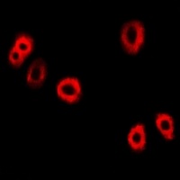 Anti-UBE2C Antibody