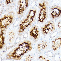 Anti-RBAT Antibody