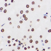 Anti-PRDM14 Antibody