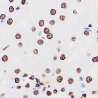 PRDM14 antibody