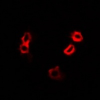 Anti-HAX1 Antibody