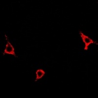 Anti-Asparagine Synthetase Antibody
