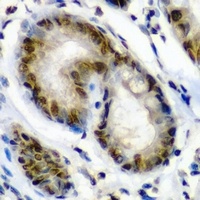 Anti-PA28 beta Antibody