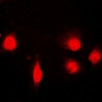 Anti-SH2B1 Antibody