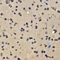 Anti-SKIV2L2 Antibody