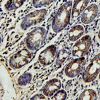 FBXL5 antibody