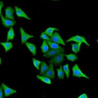 Anti-Hemopexin Antibody