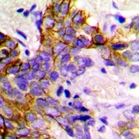 Anti-GABARAP Antibody