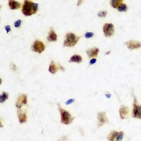 FMR1 Rabbit Polyclonal Antibody