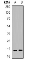 EVI1 Rabbit Polyclonal Antibody