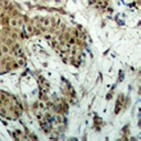 EVI1 Rabbit Polyclonal Antibody
