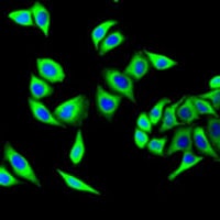Anti-FH Antibody