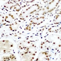 Anti-Pontin 52 Antibody