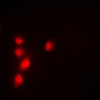 Anti-Pontin 52 Antibody