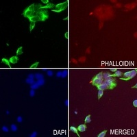 Anti-Bestrophin Antibody