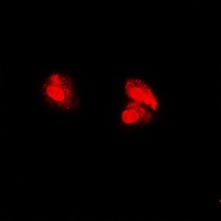 Anti-PSMA5 Antibody