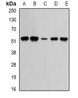 TrpRS Rabbit Polyclonal Antibody