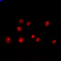 Anti-PCGF6 Antibody
