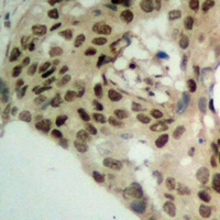 PHAP1 Rabbit Polyclonal Antibody