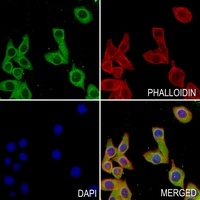 Anti-ATP5B Antibody