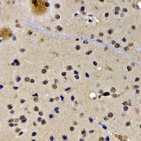 Anti-SATB1 Antibody