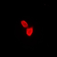 SATB1 antibody