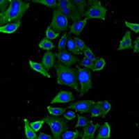 Anti-Thrombospondin-5 Antibody