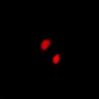 Anti-CGBP Antibody