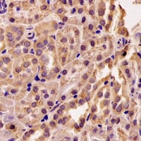 Anti-RMDN3 Antibody
