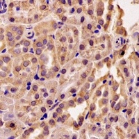 RMDN3 antibody