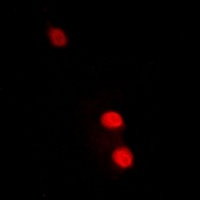 Anti-TFIIF RAP 30 Antibody