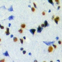 Anti-JMJD6 Antibody
