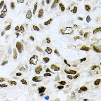 SAP145 Rabbit Polyclonal Antibody