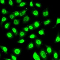 SAP145 Rabbit Polyclonal Antibody