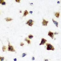 Anti-HuC Antibody