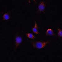 Anti-HuC Antibody