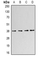 SLM-1 Rabbit Polyclonal Antibody