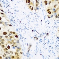 Anti-SLM-1 Antibody