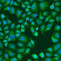 Anti-GW182 Antibody