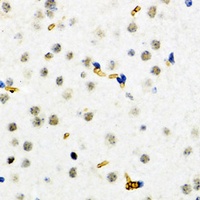 Anti-ESET Antibody