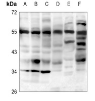 IRAK4 Antibody