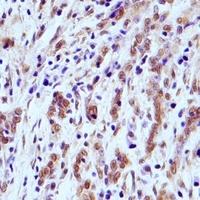 IRAK4 antibody