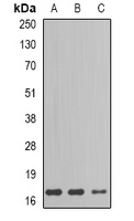 GIP Rabbit Polyclonal Antibody