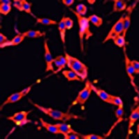 AOC1 antibody